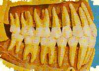 32 teeth in alignment