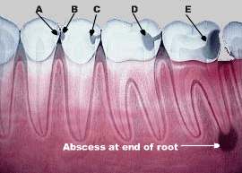 the decay process